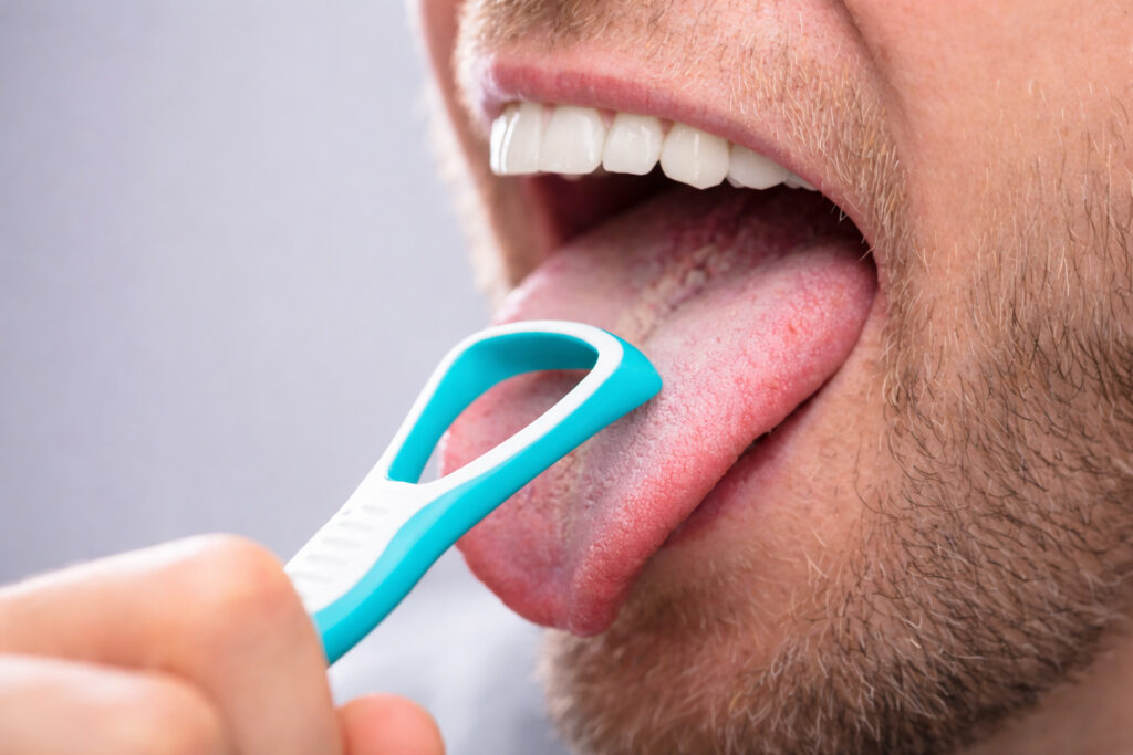 Dil yüzeyi bakımı ve ağız kokusu odaklı temizlik planlaması yapılan klinik uygulama
